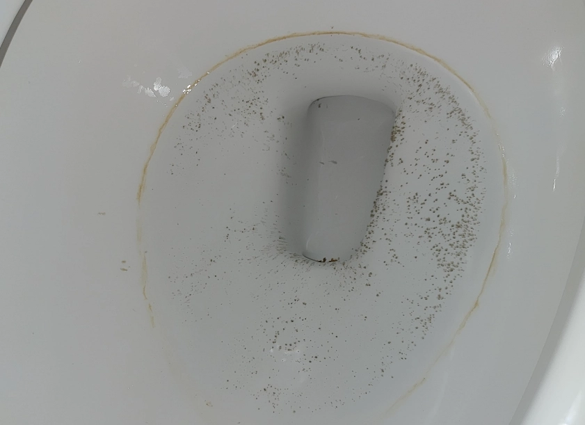 馬桶出現黑點是糖尿病前兆？醫師解析可能原因與清潔對策