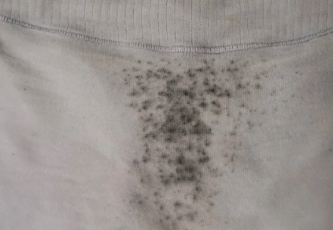 內褲黑點原因 內褲黑點原因