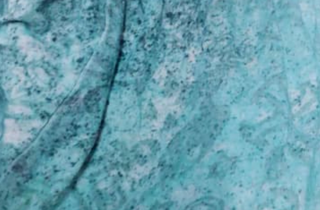 內褲發霉怎麼辦？5步驟徹底清潔與3招預防指南