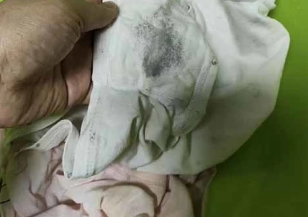 內褲有黑點？別慌！專家教你辨別黴菌、鐵鏽與污漬的真相