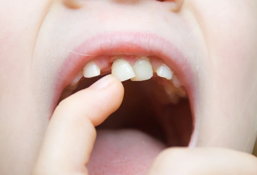 夢見牙齒鬆動脫落？完整解析夢境意義、心理學與實用應對指南