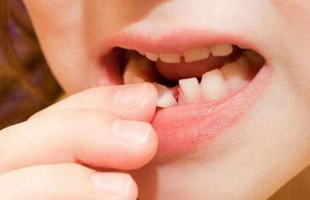 夢見牙齒鬆動脫落 意思