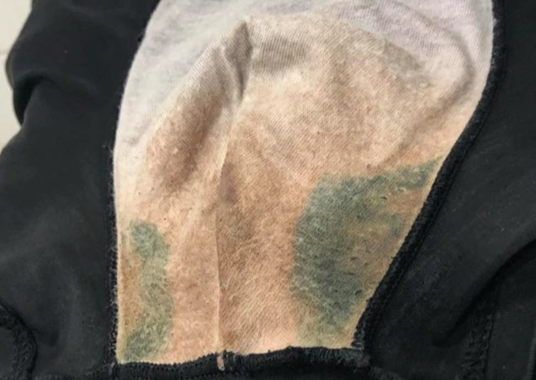 內褲發霉處理 內褲發霉處理