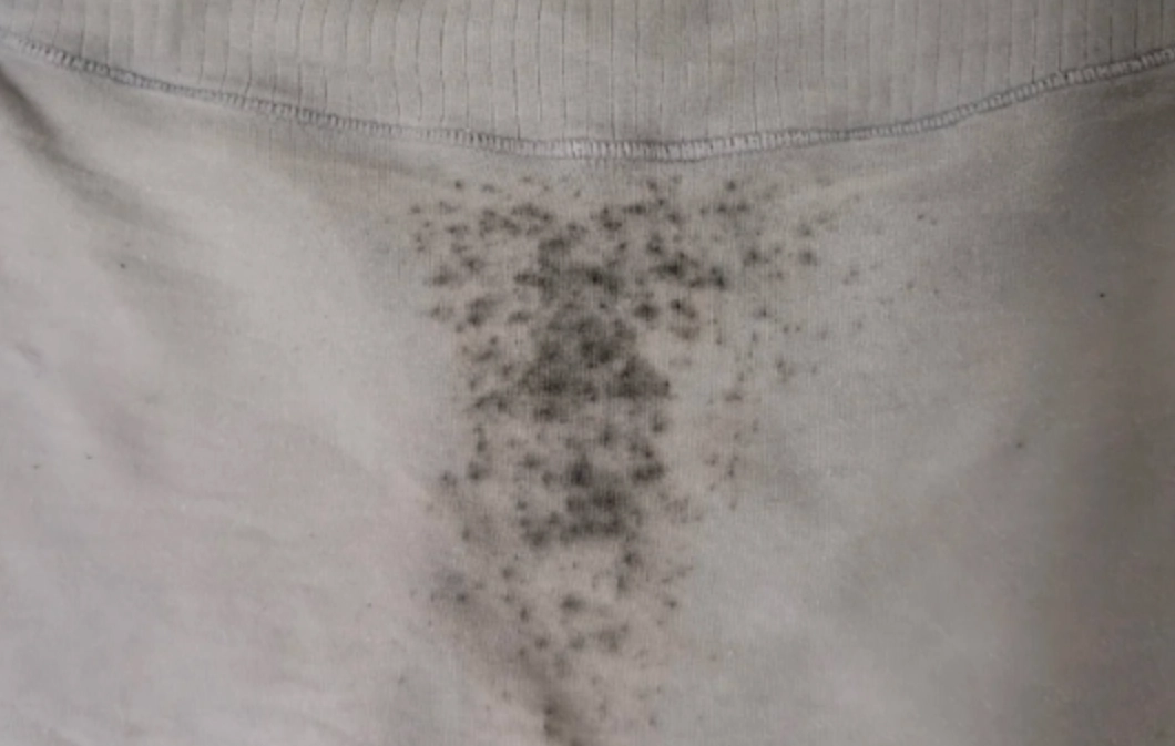 內褲發霉原因全解析：5大關鍵因素與實用解決方案