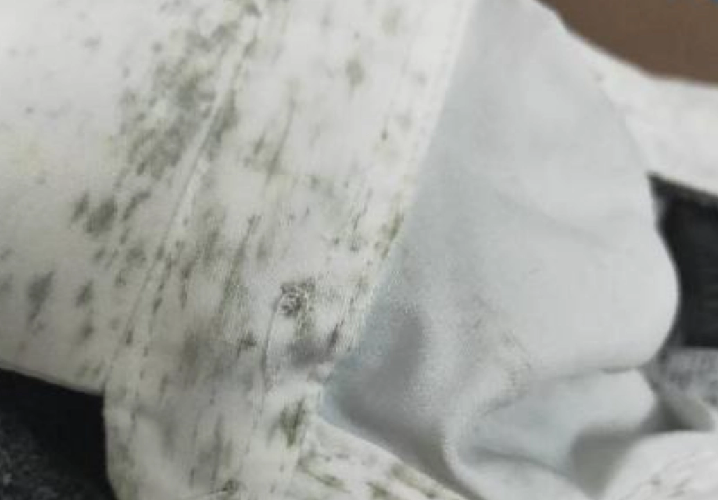 預防內褲發霉 預防內褲發霉