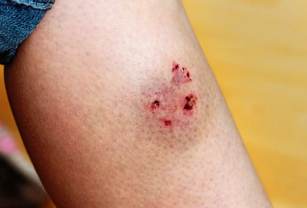 夢到被狗咬流血怎麼辦？解析夢境含義與心理狀態的深度指南