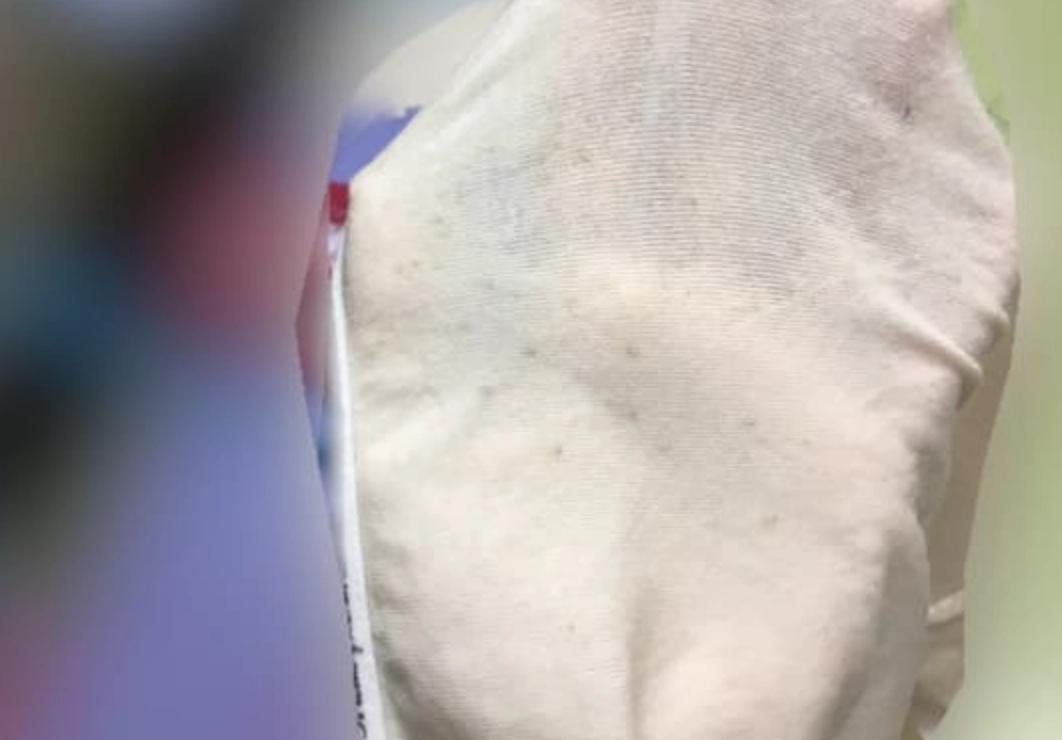 內褲發霉處理 內褲發霉處理