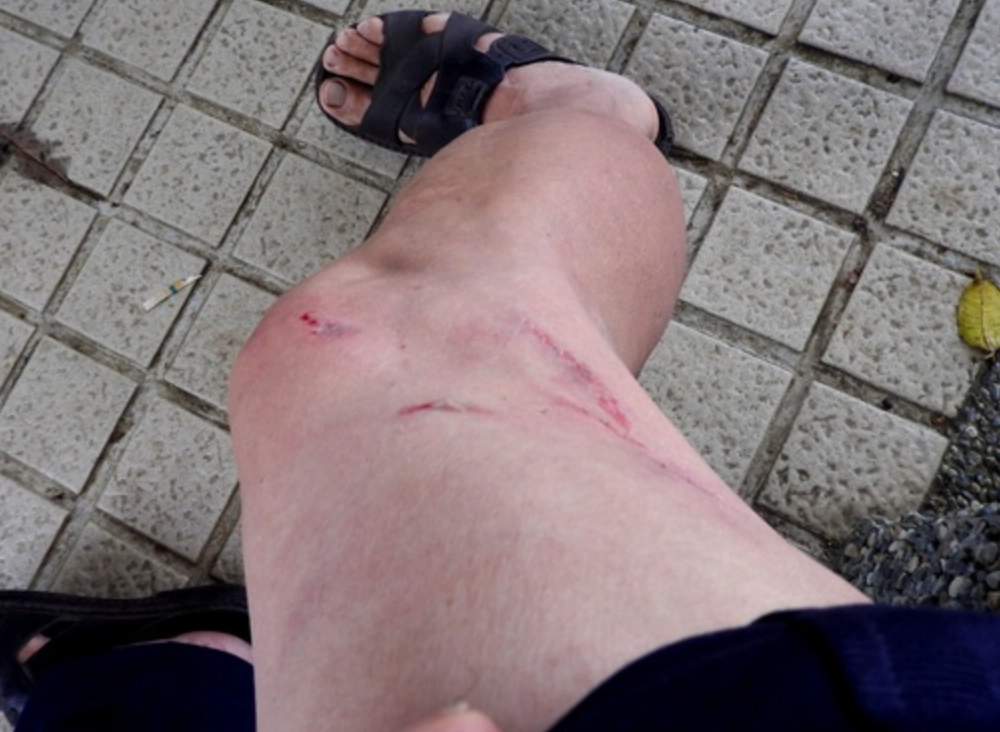 夢見被狗咬大腿：解析夢境背後的秘密與心理暗示