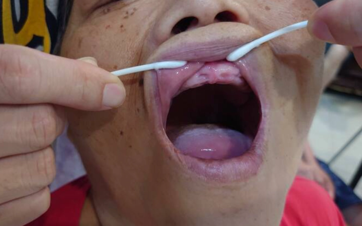 夢到牙齒掉光怎麼辦？解析5種心理成因與3個實際步驟