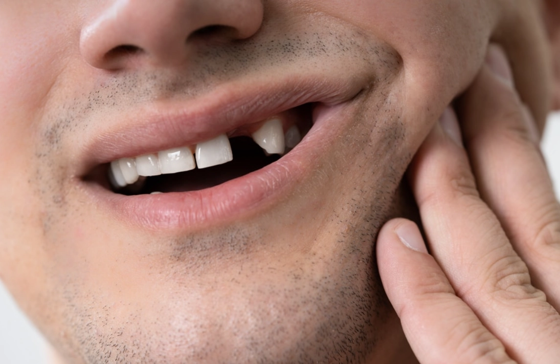 上牙掉落 夢境含義