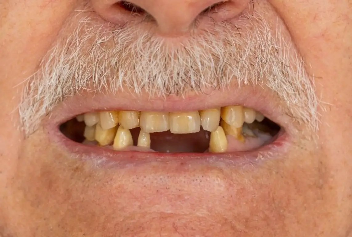 夢到掉兩顆牙齒？別只查周公解夢！心理師教你解讀3大潛意識訊息