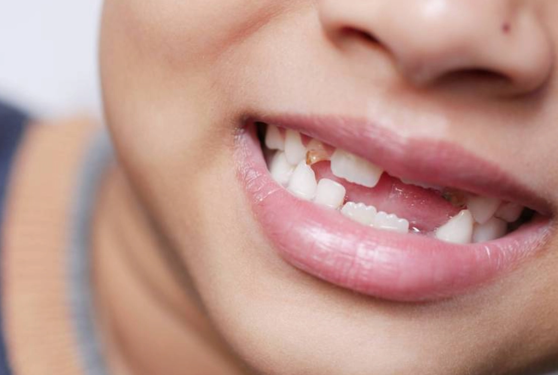 夢見掉2顆牙齒代表什麼？心理學與文化解讀全攻略