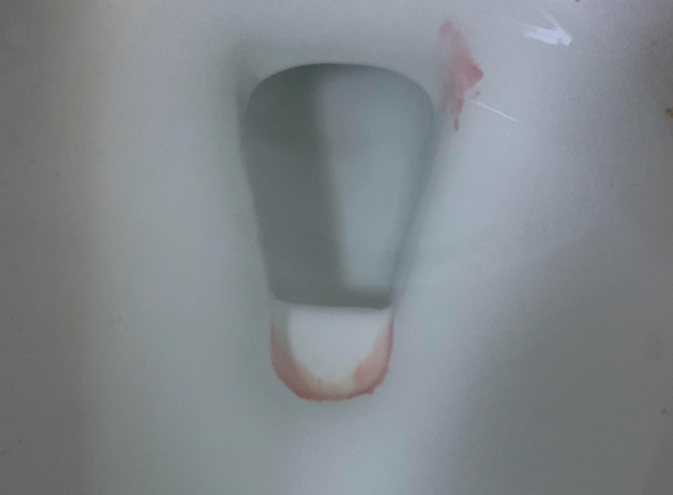 粉紅色水垢清除