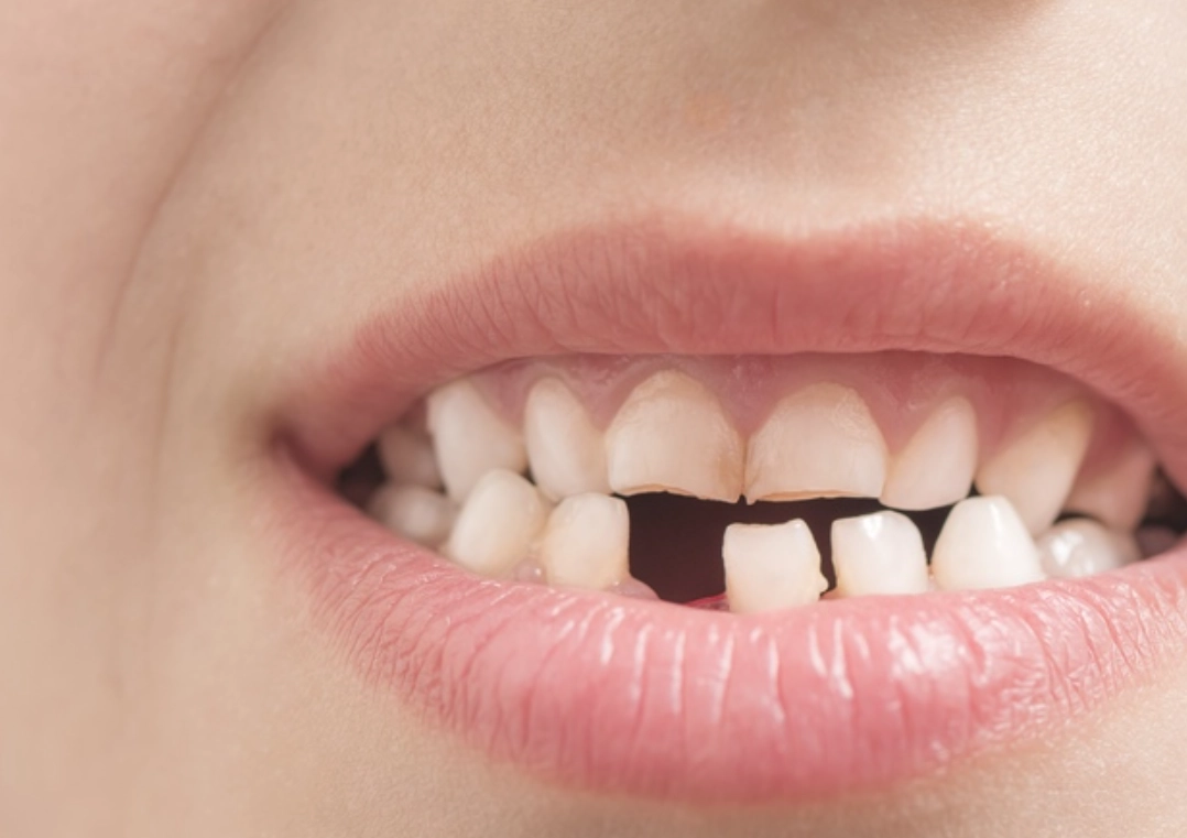 夢見掉牙齒解夢