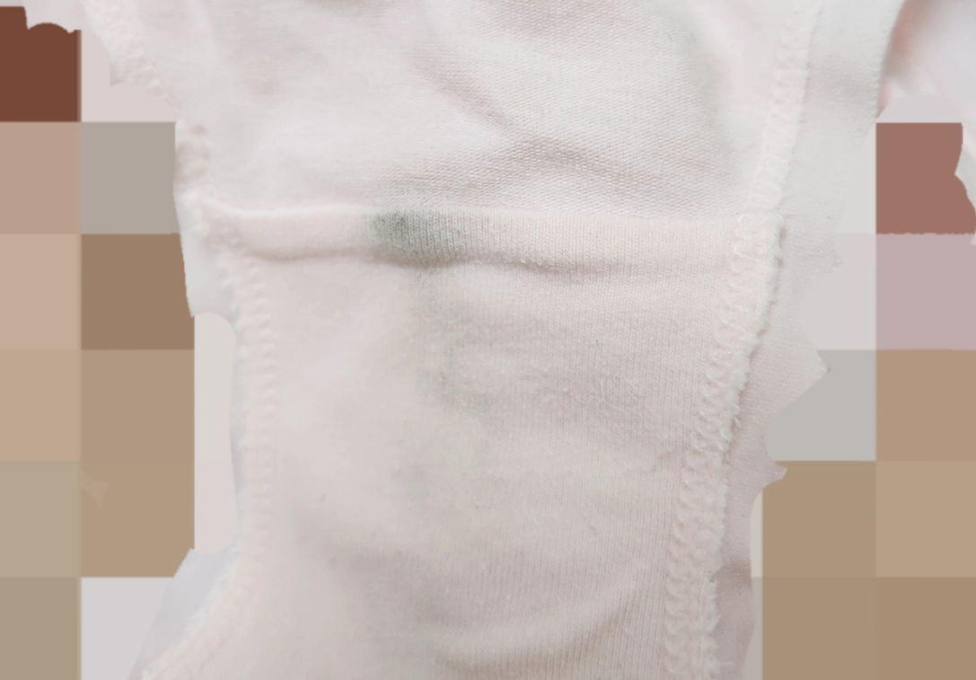 內褲發霉預防 內褲發霉預防