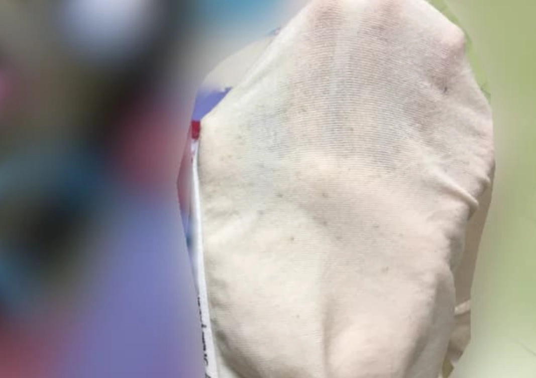 內褲發霉別丟！5步驟徹底清潔與4大預防關鍵