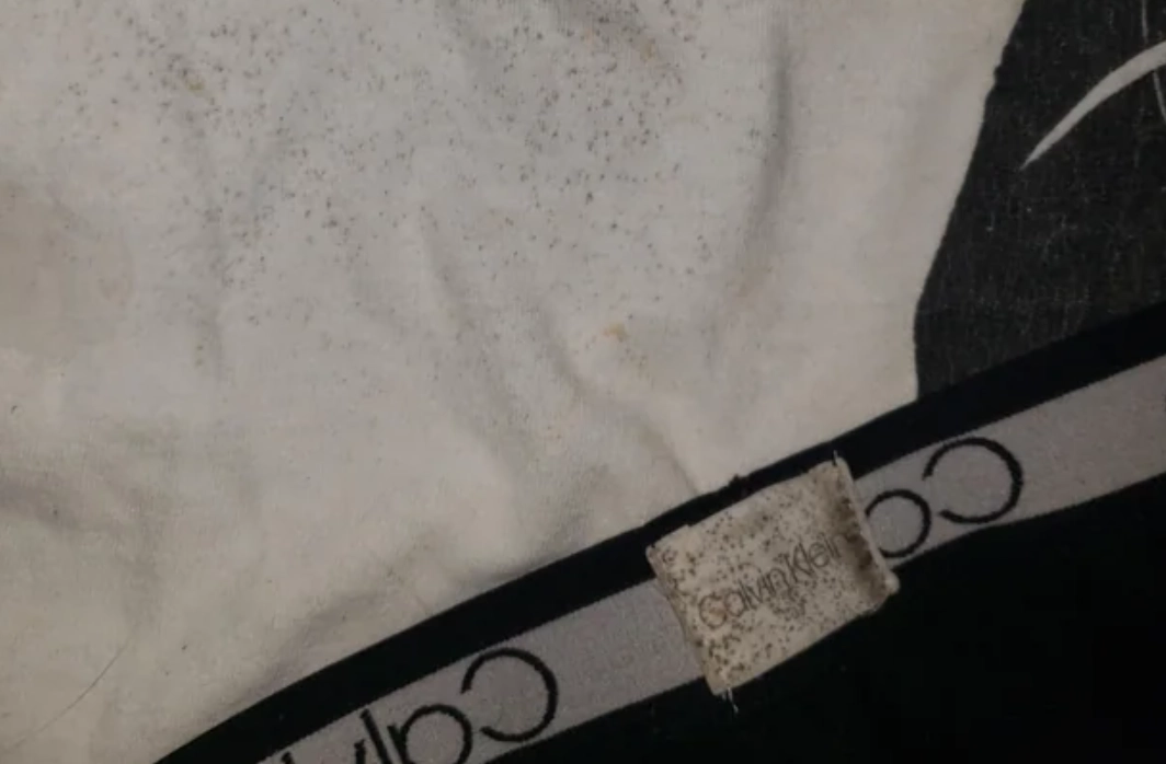 內褲發霉預防 內褲發霉預防