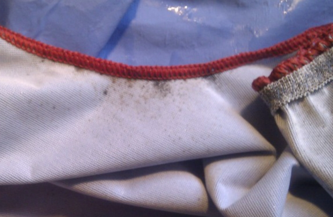 內褲發霉清潔 內褲發霉清潔