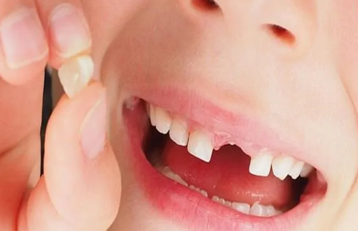 夢見牙齒掉落沒流血