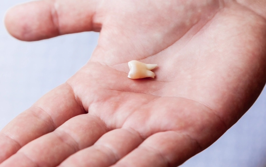 夢見掉牙齒沒流血代表什麼？周公解夢與心理學的完整解析