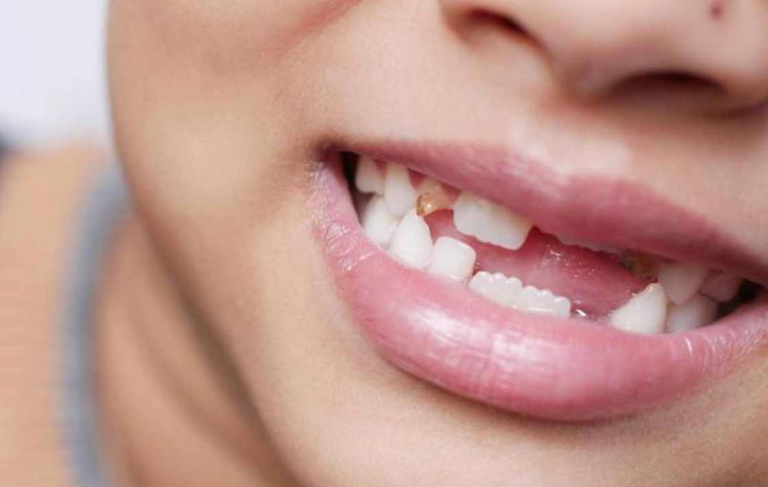 夢到掉牙齒沒流血