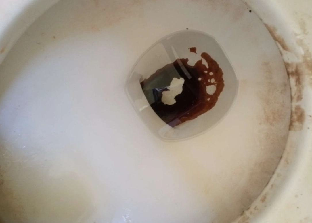 馬桶黑垢如何清除