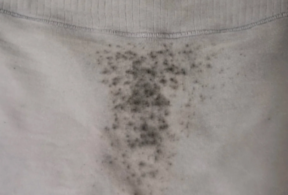 內褲發霉怎麼辦？5個步驟急救與3招終極預防法