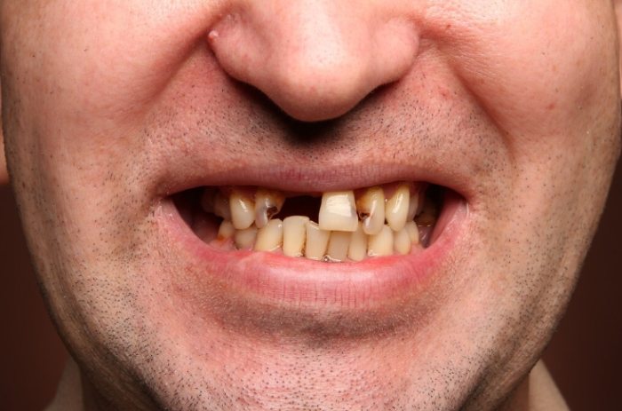 夢境號碼解析 夢境號碼解析