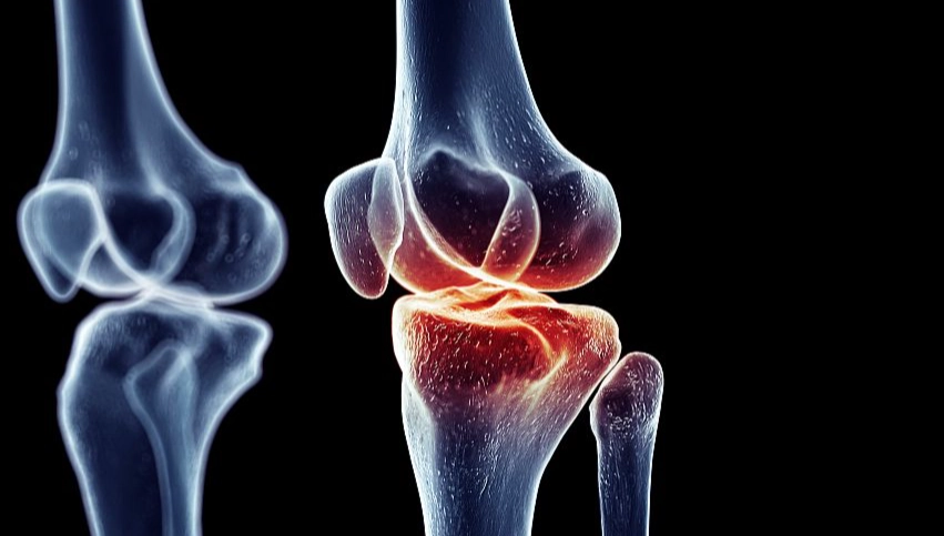 类风湿关节炎治疗 类风湿关节炎治疗