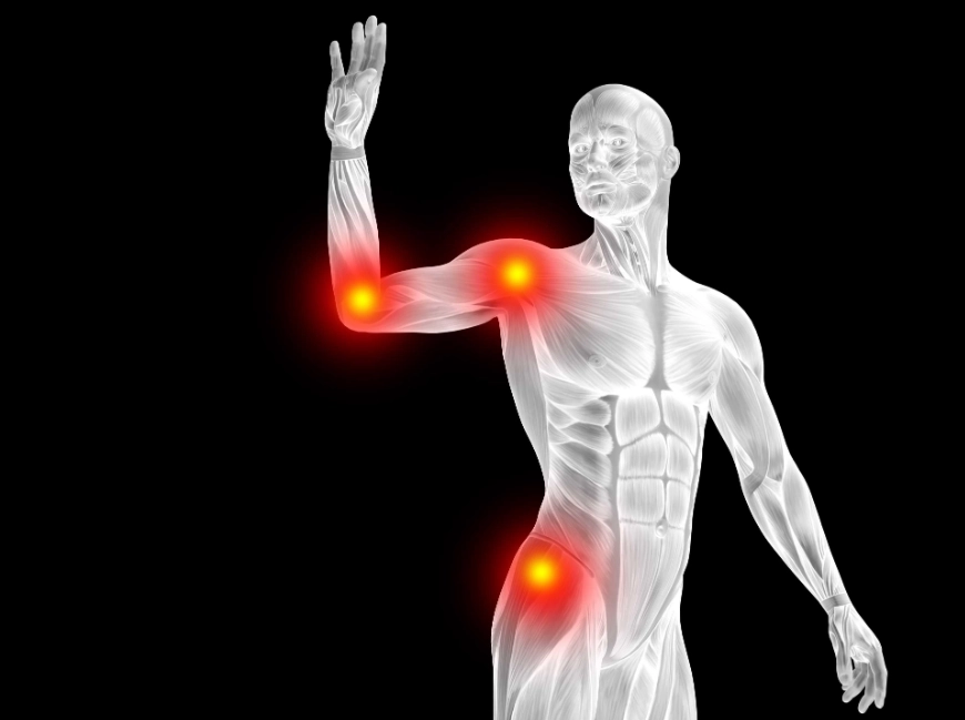 类风湿关节炎症状 类风湿关节炎症状