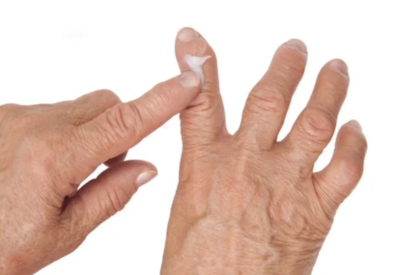 關節炎自癒方法