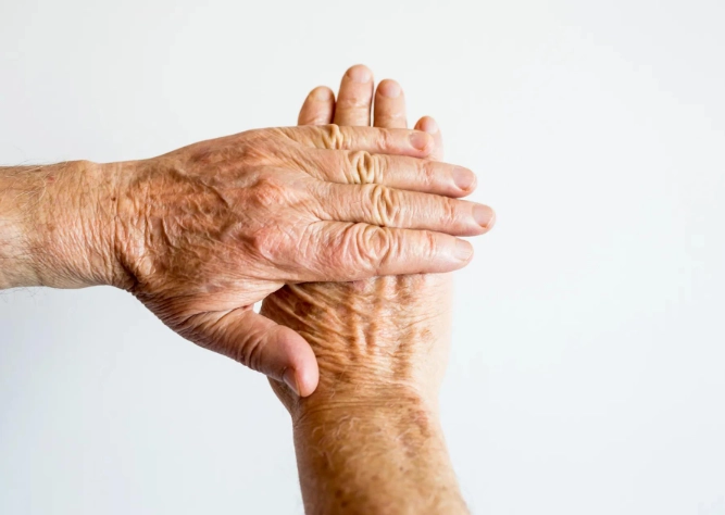 类风湿关节炎治疗 类风湿关节炎治疗