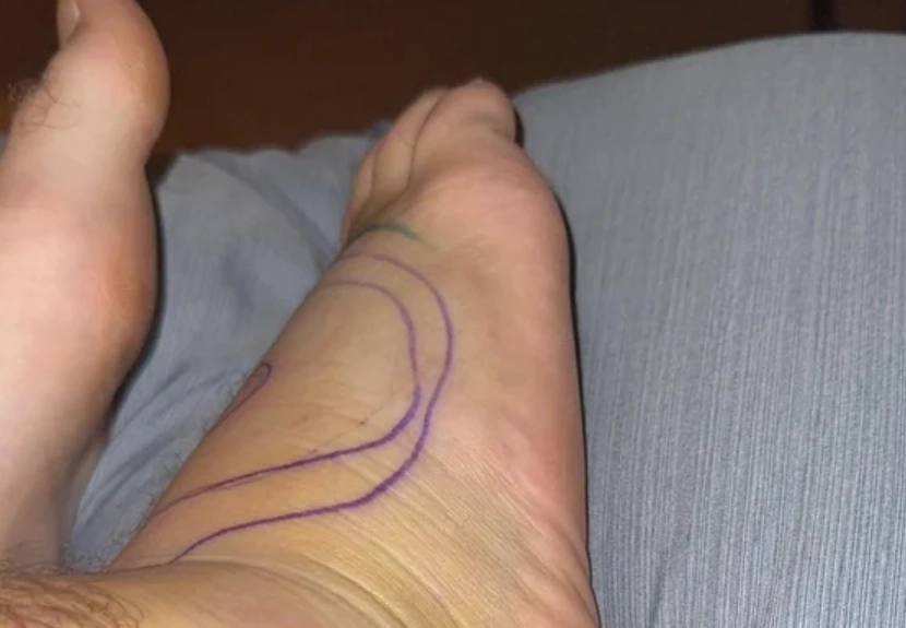 蛇咬腳趾夢境解析