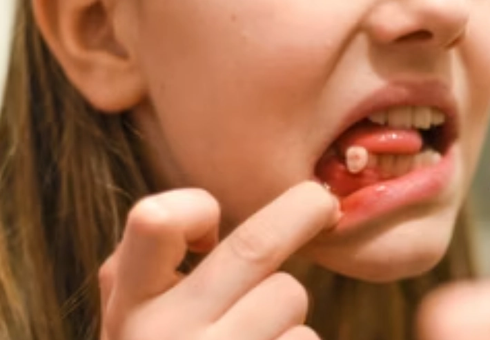 夢境解析牙齒鬆動 夢境解析牙齒鬆動