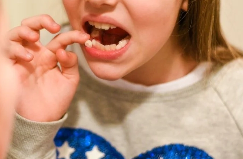 牙齒夢境心理學 牙齒夢境心理學