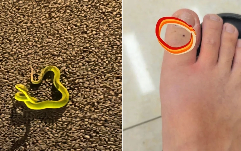 蛇咬腳趾夢境解析