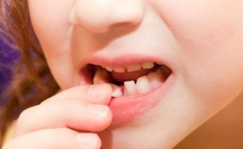 夢到牙齒鬆動解夢 夢到牙齒鬆動解夢