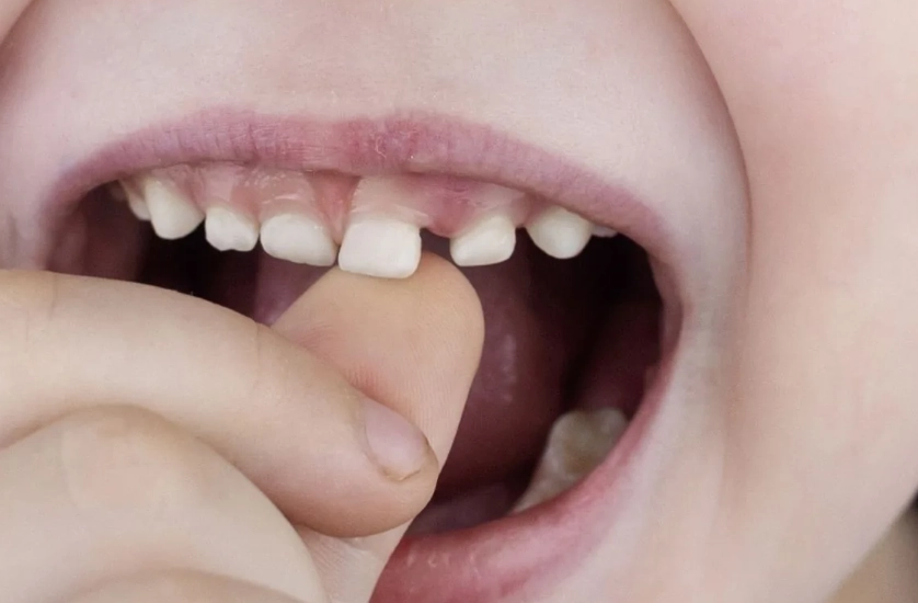 牙齒夢境心理學 牙齒夢境心理學