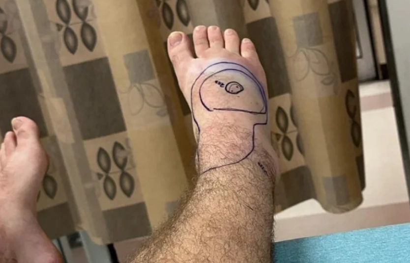 蛇咬腳趾夢境解析