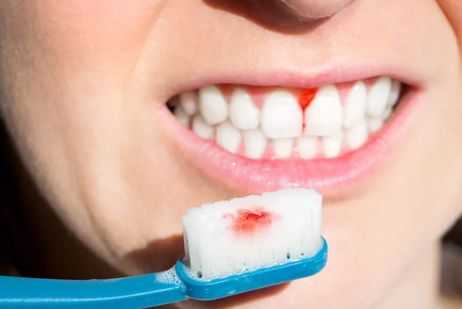 掉牙齒夢境解析 掉牙齒夢境解析