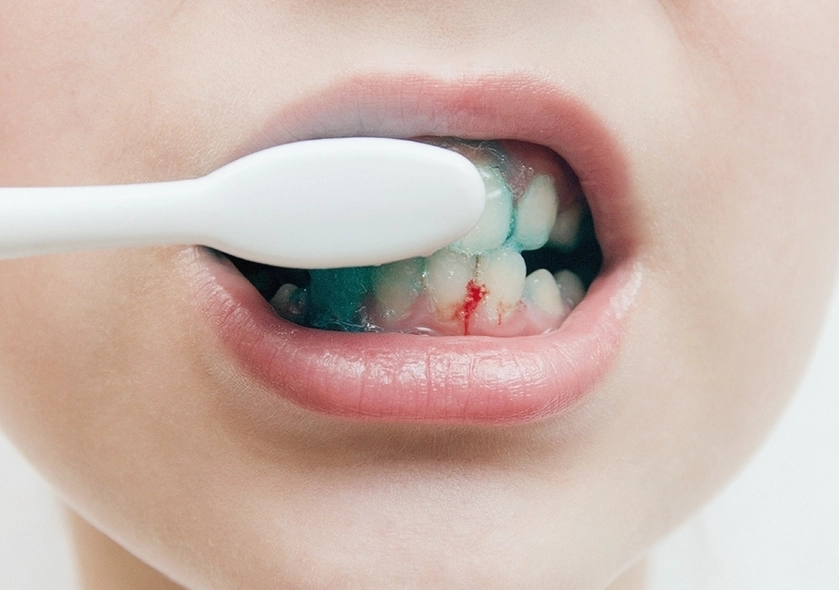 夢境流血意義 夢境流血意義