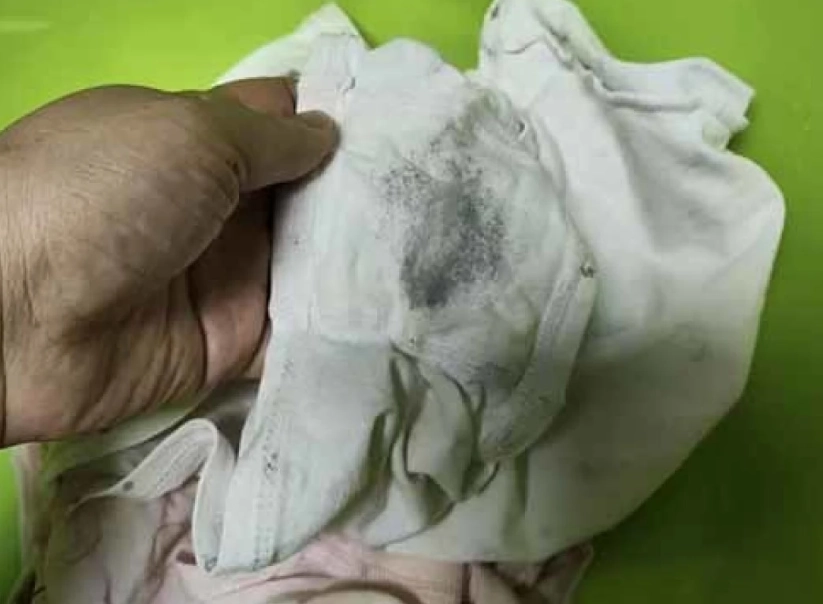 漂白水清洗內褲