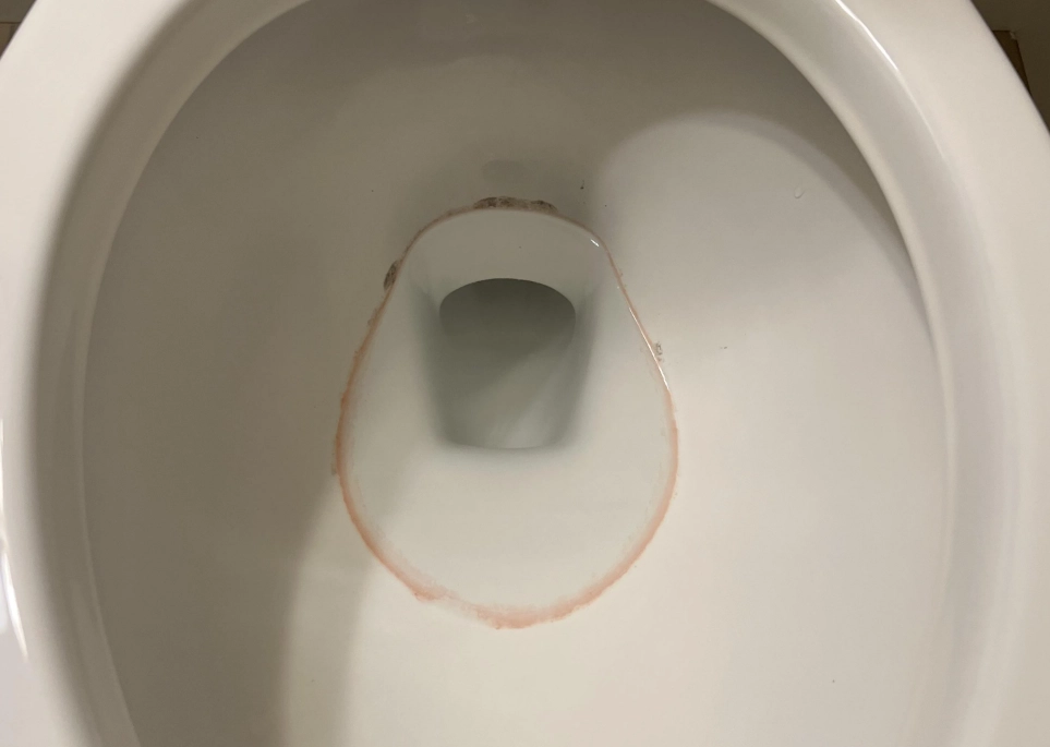 馬桶菌膜清除 馬桶菌膜清除