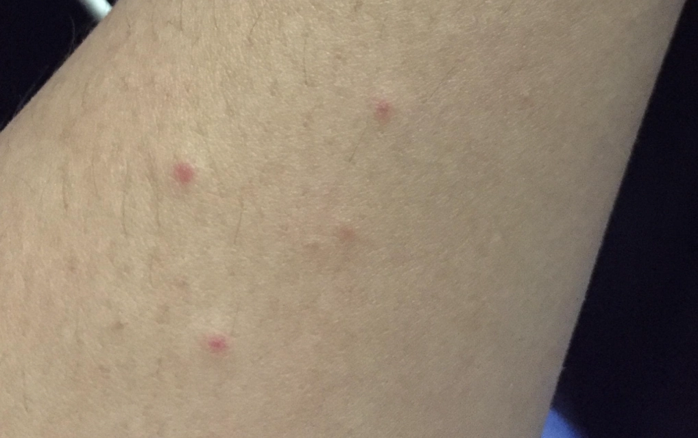 夢到被螞蟻咬 意思