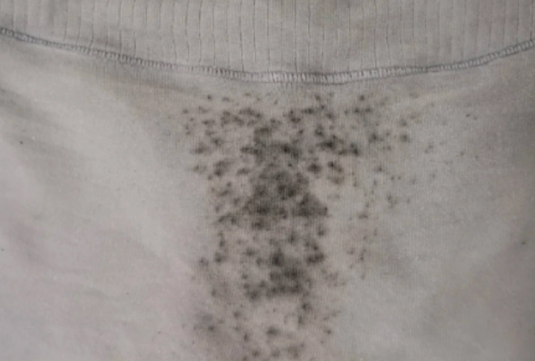 衣物發霉處理 衣物發霉處理