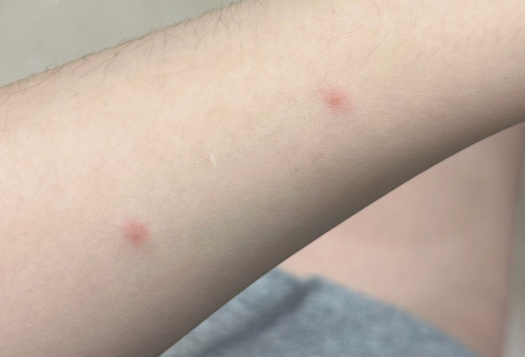 夢到被螞蟻咬 解夢