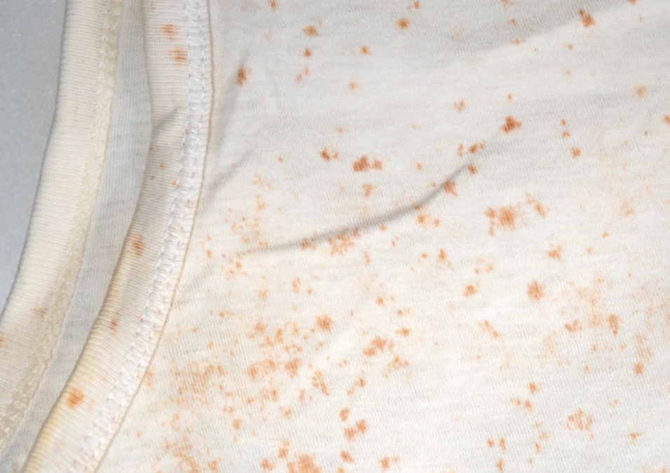 衣服霉斑去除 衣服霉斑去除