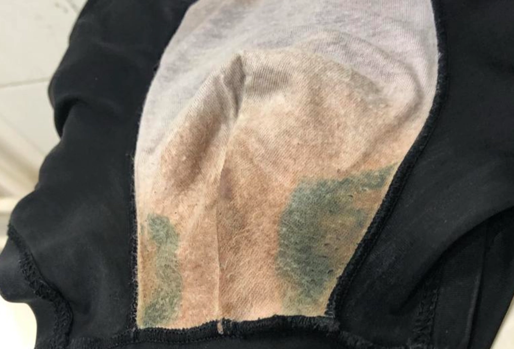 內褲發霉 內褲發霉