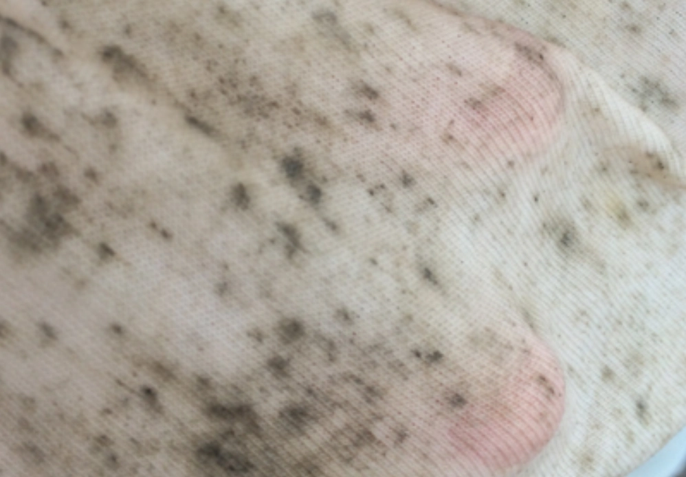 快速去霉斑 快速去霉斑