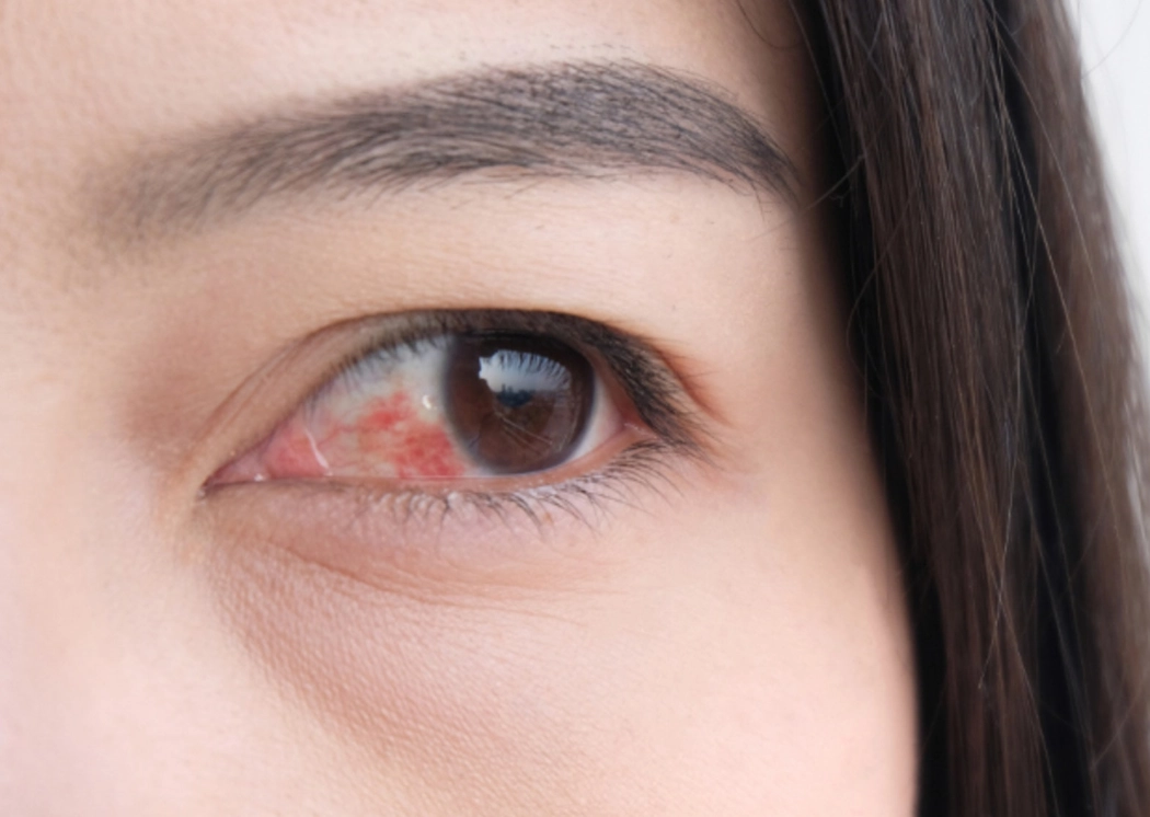 糖尿病初期症狀